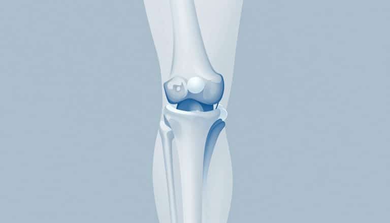 Vue latérale d’un genou montrant la rotule, le ligament rotulien et un fragment de ménisque.